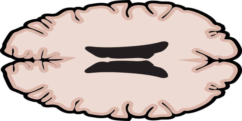 CBD-Öl Multiple Sklerose