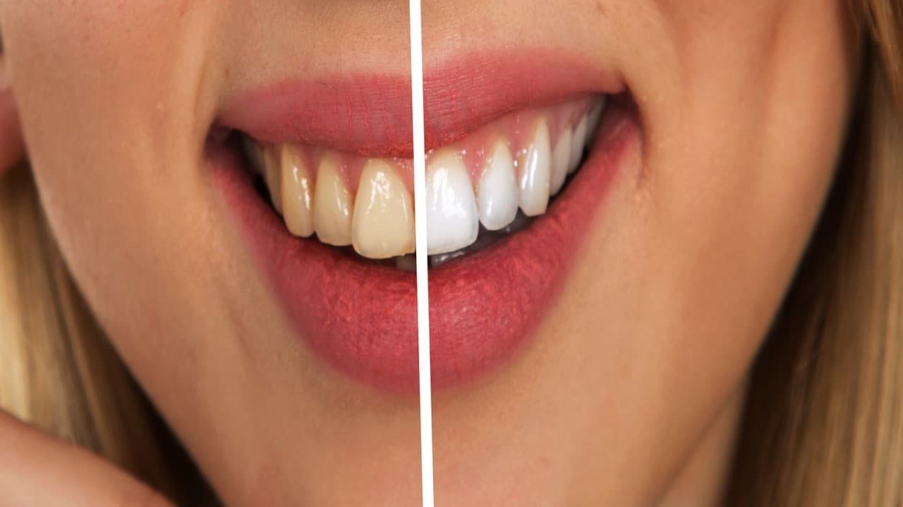 CBD Zahnpasta Gesundheit