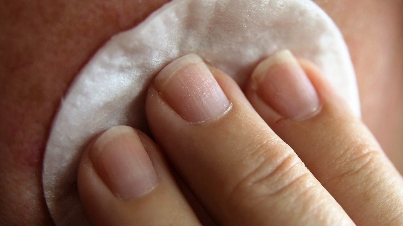 CBD Psoriasis Vulgaris