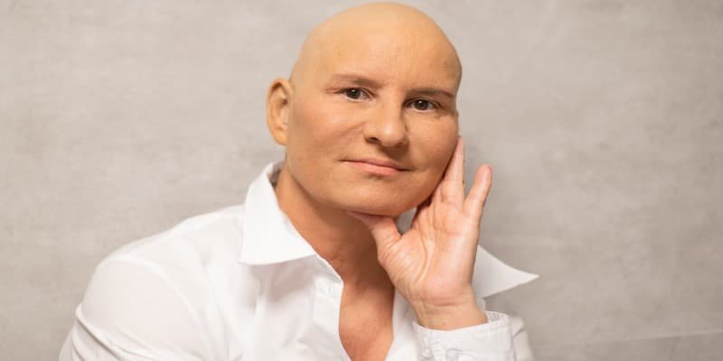 CBD-Öl Chemotherapie Beschwerden